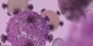 Mesotelomia pleural