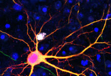 Neurona modificada, tecnología SATI