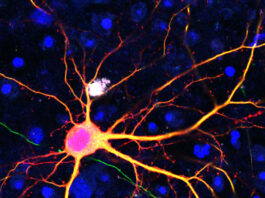 Neurona modificada, tecnología SATI