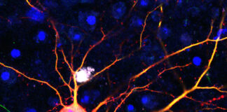 Neurona modificada, tecnología SATI