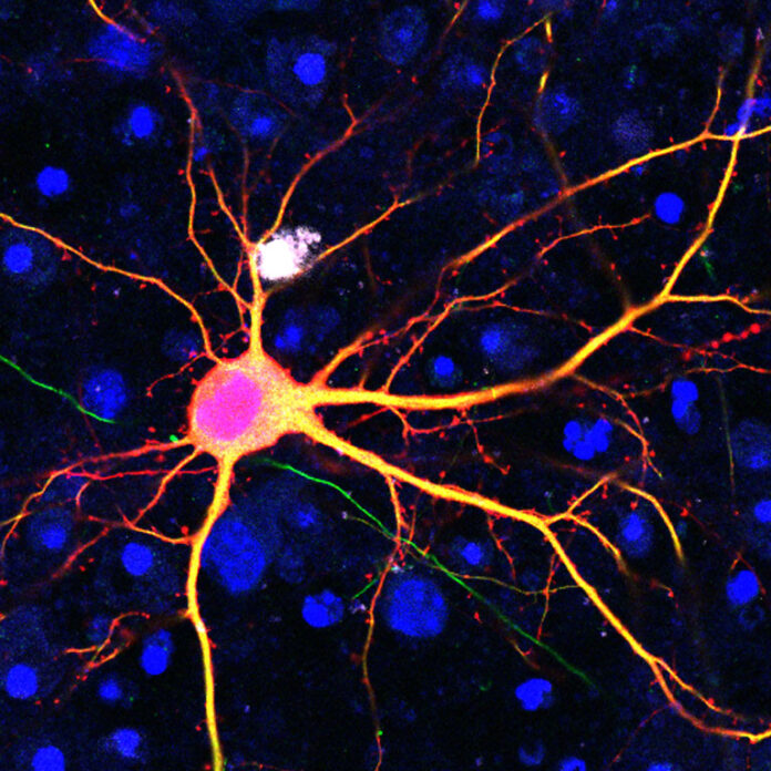 Neurona modificada, tecnología SATI