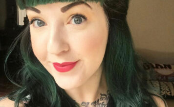 Jill, angioedema hereditario tipo 3