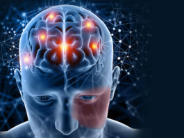 síndrome-Sturge-Weber-tratamiento-experimental