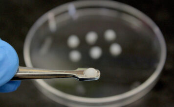 vacuna, leucemia mieloide aguda