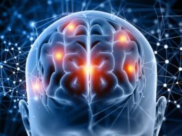 Enfermedades cerebrales, inteligencia artificial