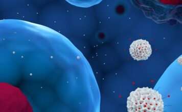 Esclerosis múltiple, médula ósea,trasplante