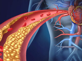 Hipercolesterolemia familiar, evolocumab tratamiento