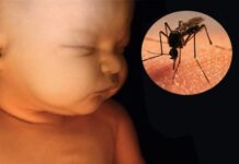 Neurodesarrollo en bebés por Zica