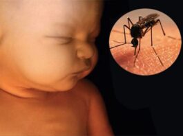 Neurodesarrollo en bebés por Zica