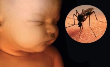 Neurodesarrollo en bebés por Zica