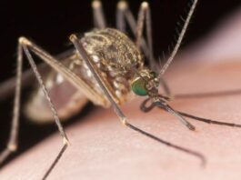 Leishmaniasis