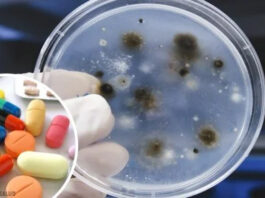 aspergilosis, enfermedad micótica