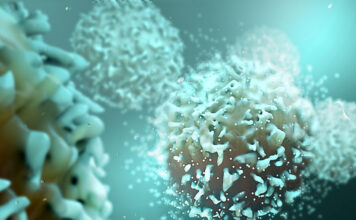 Linfoma de células de manto, tratamiento