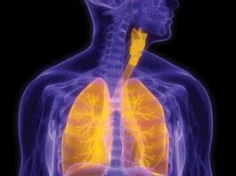 linfangioleiomiomatosis