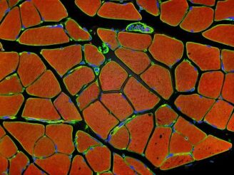 La distrofia miotónica tipo 1 afecta principalmente al sistema muscular y el sistema nervioso central. En la imagen: sección de músculo esquelético, de Tom Deerinck, National Center for Microscopy and Imaging Research (NCMIR).