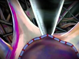 distrofia muscular de Duchenne, fisiología neuronal