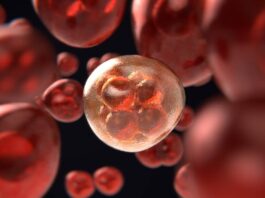 linfoma de células del manto, células CAR-T, terapia