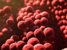 síndrome shock tóxico