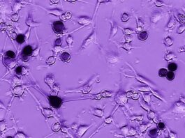 células glioblastoma, ébola