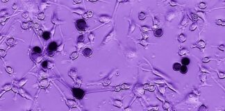 células glioblastoma, ébola