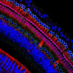 células sensoriales oído