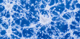 glioblastoma, trifluoperazina