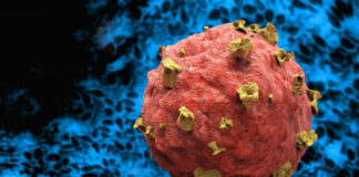 Yescarta, linfoma no Hodgkin