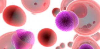 células T, esclerosis múltiple, enfermedades autoinmunes