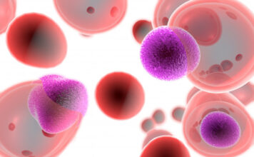 células T, esclerosis múltiple, enfermedades autoinmunes