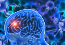 glioblastoma, proteína, Diana terapéutica