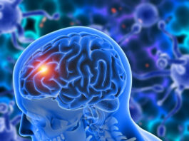 glioblastoma, proteína, Diana terapéutica