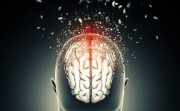 inteligencia artificial, Glioma