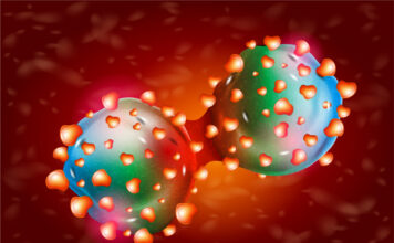 leucemia mieloide aguda, tratamientos