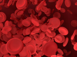 pautas clínicas, células falciformes