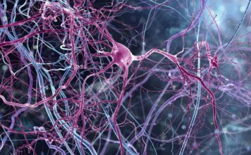 tejido nerviosos, Charcot-Marie-Tooth tipo 1A