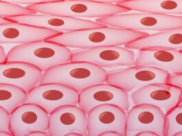 tratamiento, amiloidosis