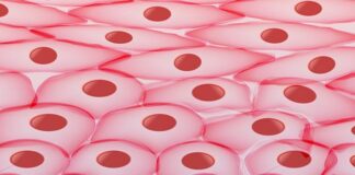 tratamiento, amiloidosis