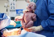 Primer caso de transmisión del SARS-CoV-2 de madre a hijo a traves de la placenta