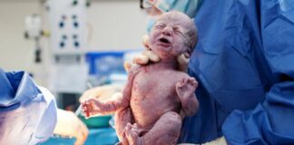 Primer caso de transmisión del SARS-CoV-2 de madre a hijo a traves de la placenta