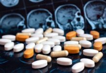 antiestaminicos, enfermedad de Huntington