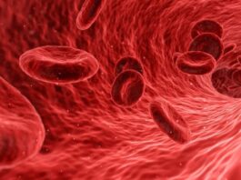 bevacizumab, fármaco, tratamiento, telangiectasia hemorragica hereditaria