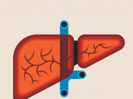 colangiocarcinoma, perfil molecular, diagnóstico