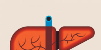 colangiocarcinoma, perfil molecular, diagnóstico
