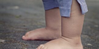 designacion rara enfermedad pediátrica, terapia, obesidad deficiencia del receptor de leptina