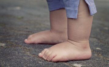 designacion rara enfermedad pediátrica, terapia, obesidad deficiencia del receptor de leptina