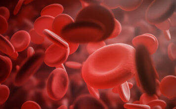 leucemia mieloide aguda, Vyxeos liposomal