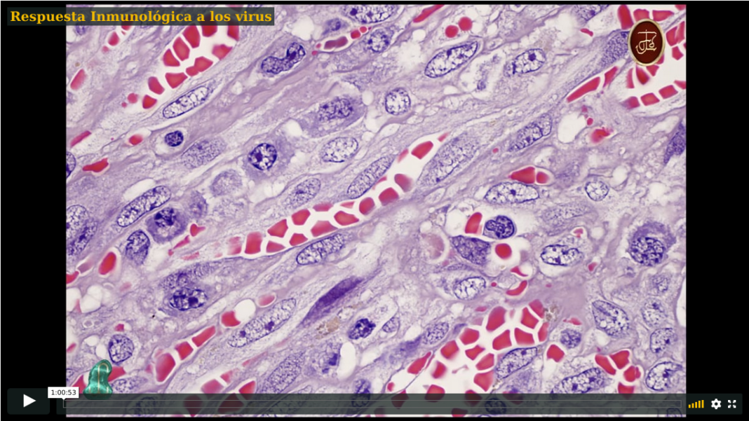 respuesta-inmunologica-a-virus_Dr-Joaquin-Carrillo-Fraga-Instituto-Hematopatologia