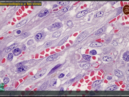respuesta-inmunologica-a-virus_Dr-Joaquin-Carrillo-Fraga-Instituto-Hematopatologia