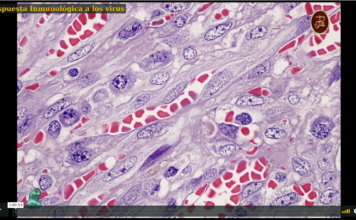 respuesta-inmunologica-a-virus_Dr-Joaquin-Carrillo-Fraga-Instituto-Hematopatologia