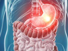 tumores del estroma gastrointestinal